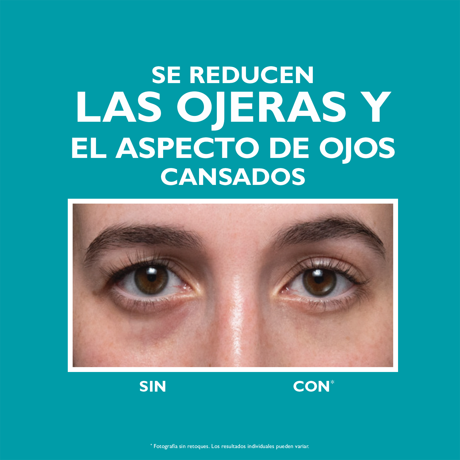 PEPTIDE SKINJECTION UNDER EYE CREAM (CREMA PARA CONTORNO DE OJOS)